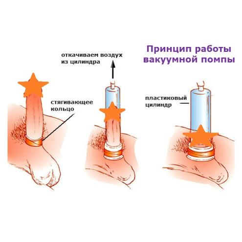 Вакуумная помпа MENZSTUFF PENIS ENLARGER RED для знающих толк в наслаждении